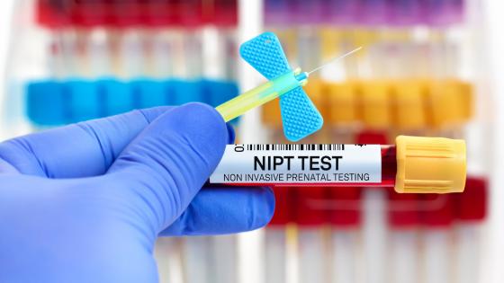 用于NIPT无创产前检查的血管和导管